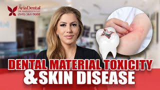 Dental Material Toxicity and Skin Disease  Aria Dental  Maryam Horiyat DDS [upl. by Choong118]