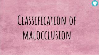 Angles Classification of Malocclusion  Easily Explained [upl. by Ricoriki]