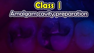 Operative  class amalgam cavity preparation [upl. by Edaw]