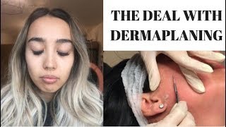 THE DEAL WITH DERMAPLANING [upl. by Bonaparte]