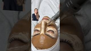 Watch Out BB Glow Facial Could Be Your Beauty Nightmare [upl. by Agemo336]