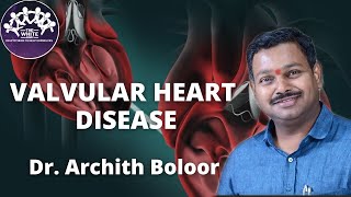 VALVULAR HEART DISEASE [upl. by Nomad831]