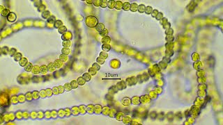 Nostoc commune  the nitrogen fixing cyanobacterium [upl. by Ynaiffit511]