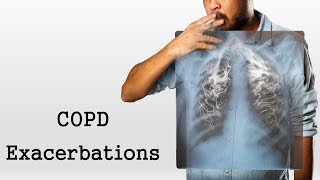 COPD Exacerbations [upl. by Hospers]