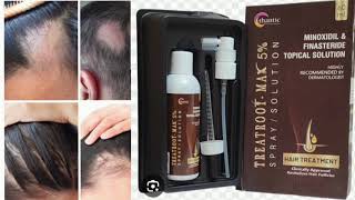 TREATROOT MAX 5 SPRAY SOLUTION MINOXIDIL amp FINASTERIDE TOPICAL SOLUTION [upl. by Riesman]