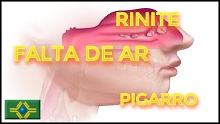 FALTA DE AR  incômodo peito e costas  PIGARRO persistente  RINITE Hipertrófica  VACINA [upl. by Berrie]