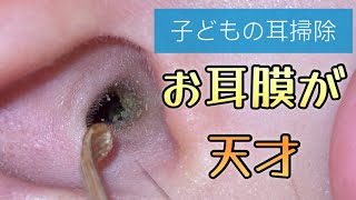 子どもの耳掃除 お耳膜のファーストインパクト👂 [upl. by Charlean911]