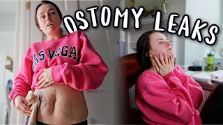 Im Over These Leaks So Im Ordering Different Ostomy Supplies  Lets Talk IBD [upl. by Asirap]