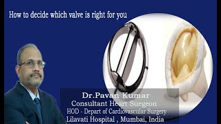 How to choose right prosthetic valve [upl. by Hieronymus]