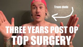 I had TOP SURGERY 3 years ago [upl. by Means]