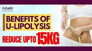 how to lose fat without exercise  Ulipo [upl. by Lief]