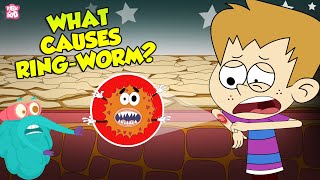 What Causes Ringworms  Skin Infection  The Dr Binocs Show  Peekaboo Kidz [upl. by Christmas]