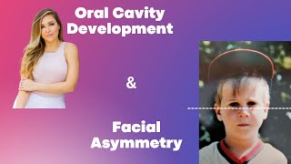 Facial Asymmetry and Oral Cavity Development with Dr Marielly Mitchell [upl. by Berneta]