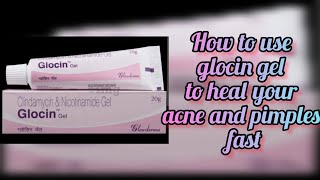 REVIEWS ON GLOCIN GEL  HOW TO HEAL ACNE AND PIMPLES FAST  USE OF GLOCIN GEL [upl. by Nial]