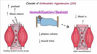 Orthostatic Hypotension Described Concisely [upl. by Stockton94]