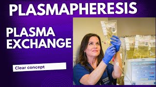 What is Plasmapheresis  How Plasmapheresis works [upl. by Chappy]