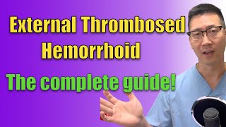 External thromboses hemorrhoid EVERYTHING you need to know [upl. by Gapin]