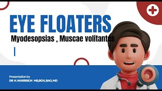 ✅Eye floaters ✅ Myodesopsias or ✅Muscae volitantes  Eyefloaters Myodesopsias or Muscaevolitantes [upl. by Scherle]