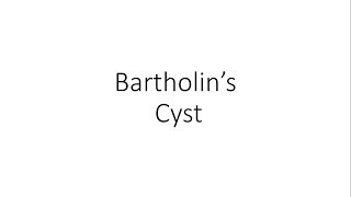 Bartholins Cyst  Gynecology [upl. by Irap641]