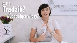 DSS14 Trądzik Wypadające włosy Mamy na to sposób [upl. by Keeton]