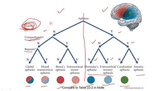 Membedakan Afasia Aphasia Wernickes Brocas Transcortikal Motorik Sensorik Global Conductive [upl. by Yrtsed]