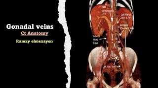 gonadal vien anatomy [upl. by Tyrrell]