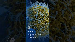 Marburg virus  Uveitis eyeconfacts eyedisease [upl. by Elwee962]