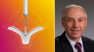 Mitral Valve Awareness Transcatheter Mitral Valve Repair amp Replacement with Dr Howard Herrmann [upl. by Lonne616]