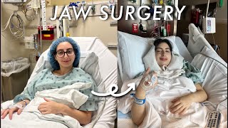 I had double jaw surgery  Vlog  1month Recovery [upl. by Moore]