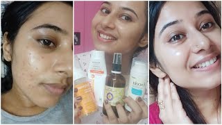 Honest amp Updated Morning Skincare Routine to remove pimple Marksacne scarsdark spotsPigmentation [upl. by Lemire273]