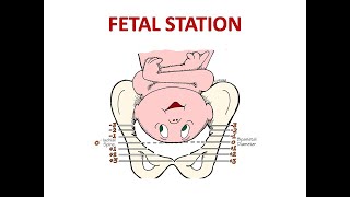 FETAL HEAD STATION [upl. by Sivek]