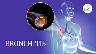 Know About Bronchitis Types Causes Symptoms Treatment And Prevention  CARE Hospitals [upl. by Jarlen]