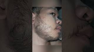 Kirkland Minoxidil Beard Journey 4 MONTH TRANSFORMATION [upl. by Eerot981]