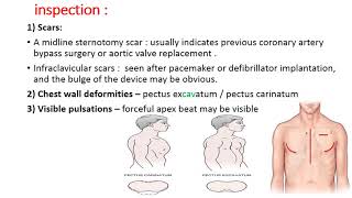 CS 2 CARDIOVASCULAR EXAMINATION  Precordium  by Dr Zaid [upl. by Eical126]