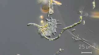 Mayorella sp  a naked hunting amoeba [upl. by Indira]