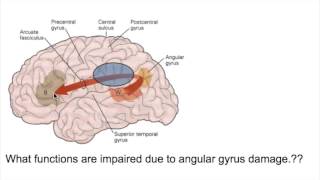 PROSOPAGNOSIA Face blindnessANGULAR GYRUS LESIONS [upl. by Ghassan377]