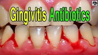 Gingivitis Antibiotics  What is the Best ANTIBIOTIC for Gingivitis [upl. by Wilscam91]