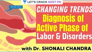 Changing Trends Diagnosis of Active Phase of Labor amp Disorders  NEET PG 2021  Dr Shonali Chandra [upl. by Lavud]