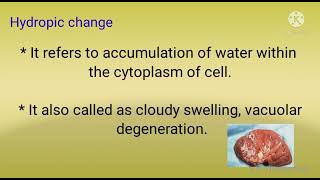 Hydropic change pathology  morphology of reversible cell injury part1 [upl. by Malamut]