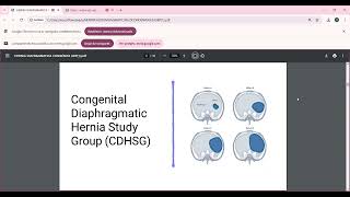 CLASE 4  HERNIA DIAFRAGMATICA CONGÉNITA URP [upl. by Nylirehs]