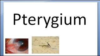 Ophthalmology 096 a Pterygium What is in Eye Type Part Fuch Spots Islet of Vogt Stocker line [upl. by Airrat]