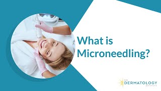 What is Microneedling  Microneedling Treatment [upl. by Scornik249]