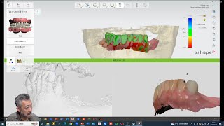 3Shape インプラントスタジオ 実演シリーズ Part1 [upl. by Jamil]