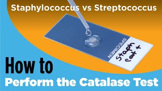 How to Perform the Catalase Test  Staphylococcus vs Streptococcus [upl. by Bohlen]