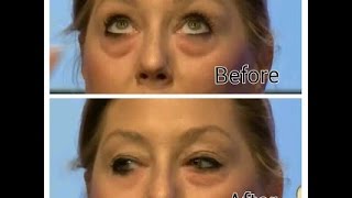 INSTANTLY AGELESS EYE LIFT CREAM [upl. by Euqinamod]