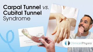 Carpal Tunnel Syndrome vs Cubital Tunnel Syndrome  Expert Physio Guide [upl. by Aicilak804]