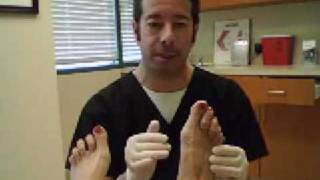 Bunions by Dr Leo Krawetz Understanding Bunions [upl. by Adiasteb]