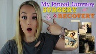 MY PINEAL JOURNEY PART 3  Warning I cry lots  ♡ Surgery amp Recovery [upl. by Erda]