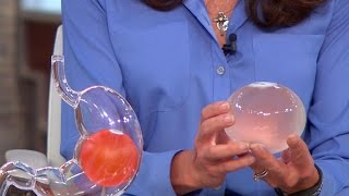 New balloon capsule could take bite out of obesity [upl. by Ateloiv451]