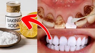 Teeth Whitening In Just 2 Minutes at Home Urdu Hindi  Irfan Azeem [upl. by Ydualc]